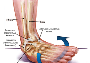 torção de tonozelo imagem ilustrando os ligamentos